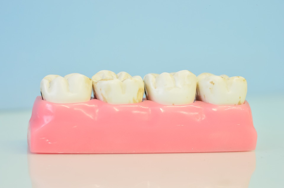 Top 5 Dental Tips